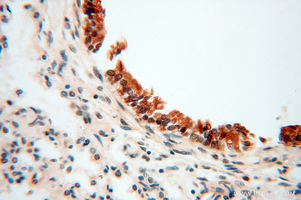 Immunohistochemistry (IHC) staining of human lung tissue using RUVBL2 Polyclonal antibody (10195-1-AP)