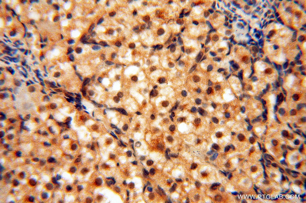 Immunohistochemistry (IHC) staining of human ovary tissue using RUVBL2 Polyclonal antibody (10195-1-AP)