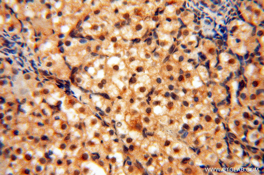 IHC staining of human ovary using 10195-1-AP