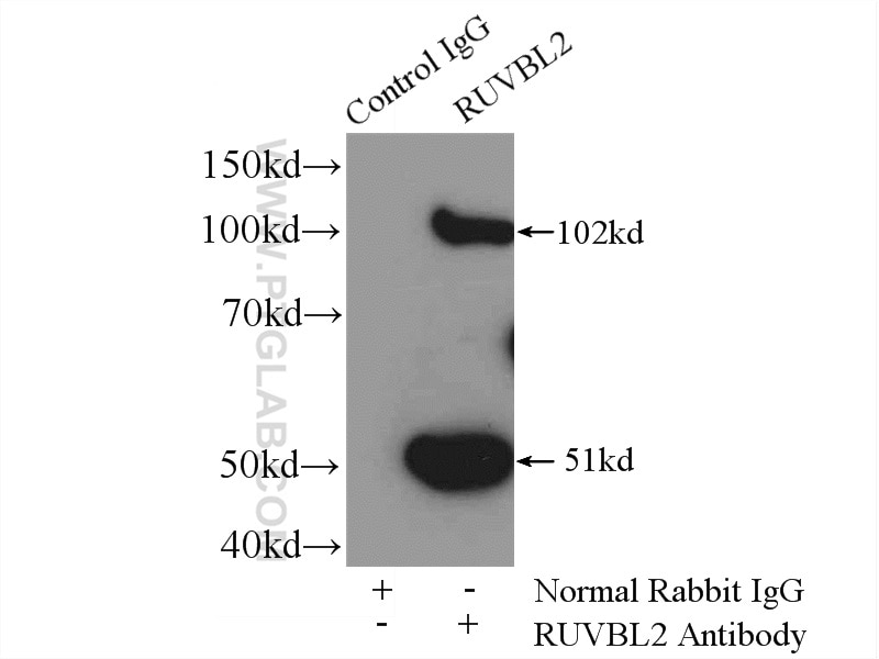 IP experiment of mouse brain using 10195-1-AP