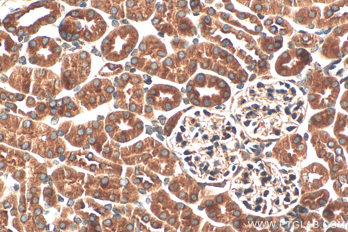 Immunohistochemistry (IHC) staining of mouse kidney tissue using RWDD1 Polyclonal antibody (17036-1-AP)