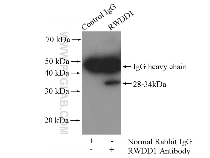 Immunoprecipitation (IP) experiment of mouse thymus tissue using RWDD1 Polyclonal antibody (17036-1-AP)