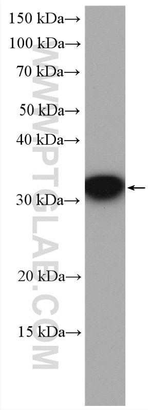 Western Blot (WB) analysis of HeLa cells using RWDD1 Polyclonal antibody (17036-1-AP)