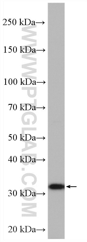 Western Blot (WB) analysis of HeLa cells using RWDD1 Polyclonal antibody (17036-1-AP)