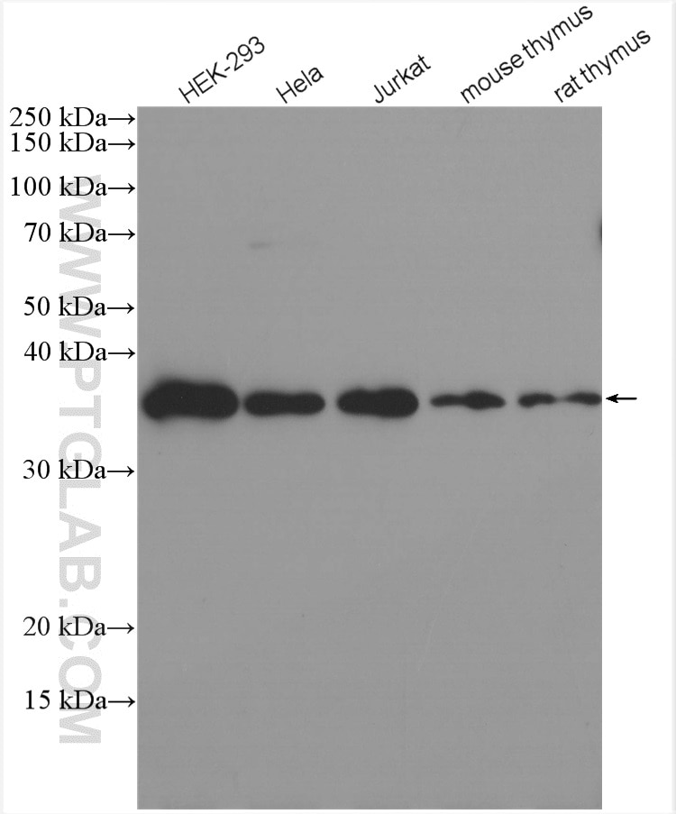 Western Blot (WB) analysis of various lysates using RWDD1 Polyclonal antibody (17036-1-AP)