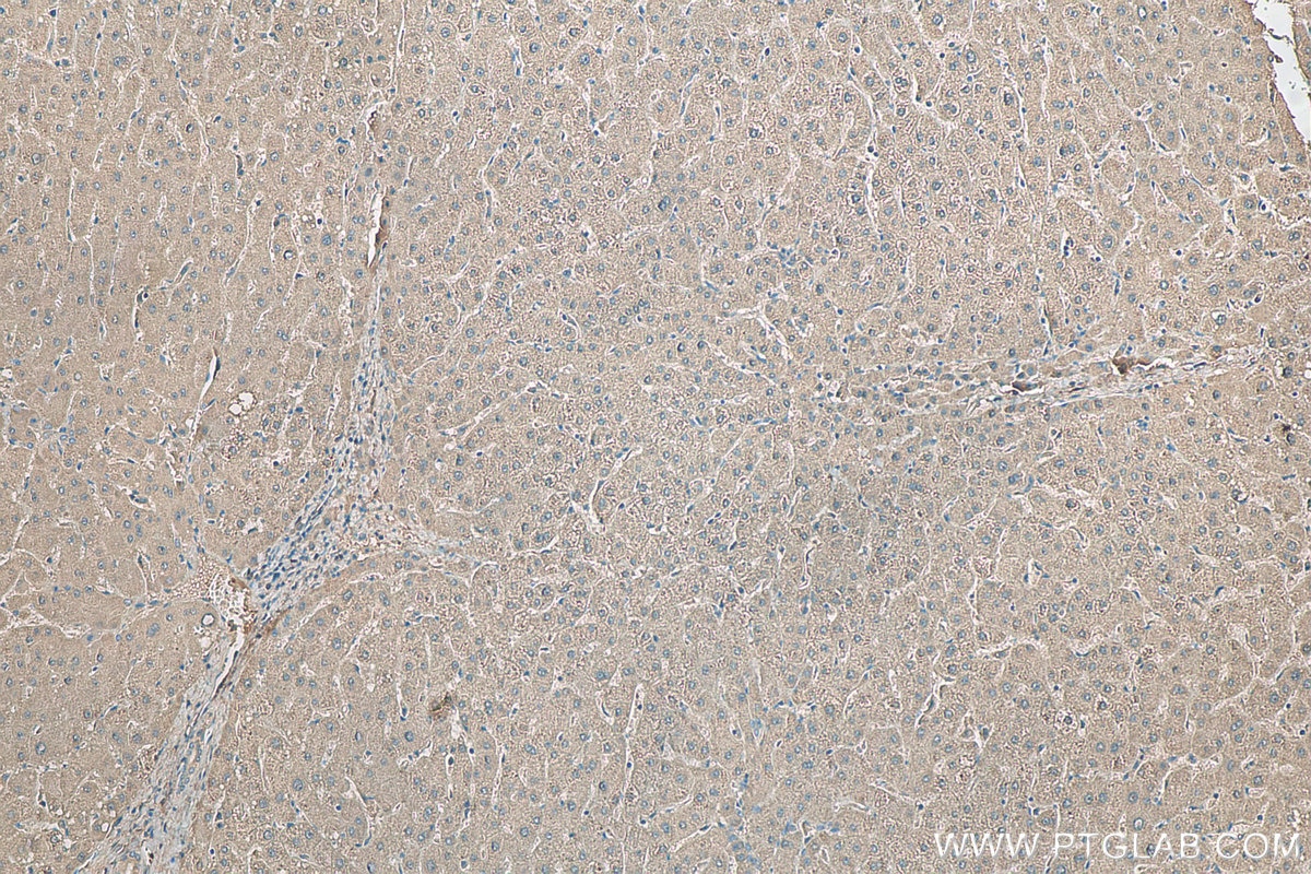 Immunohistochemistry (IHC) staining of human liver tissue using RWDD3 Polyclonal antibody (22737-1-AP)