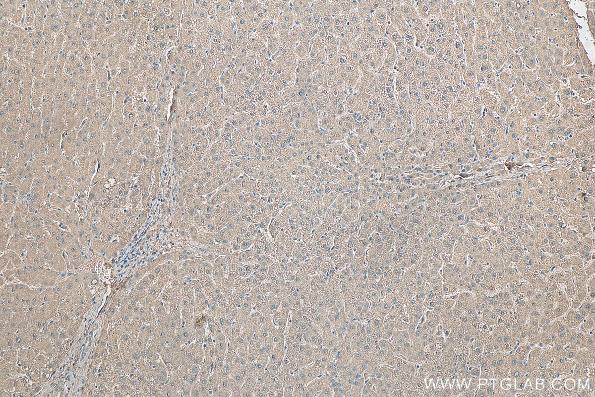 IHC staining of human liver using 22737-1-AP