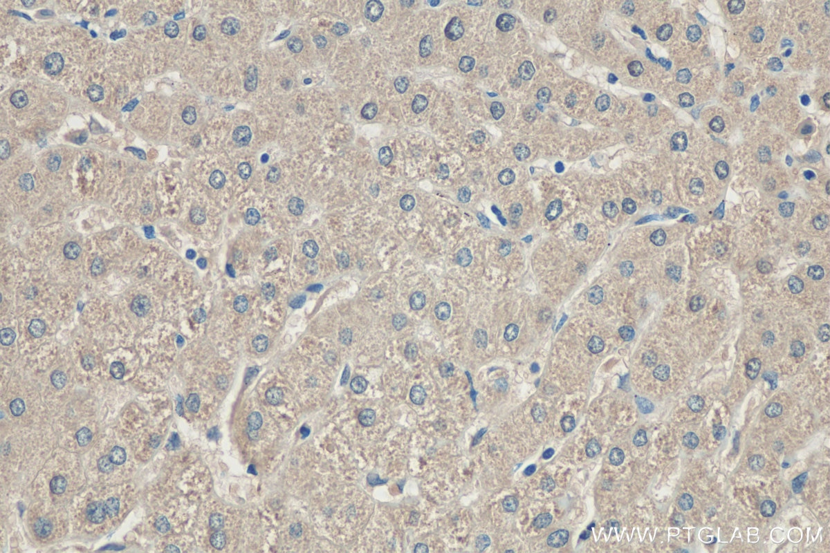 Immunohistochemistry (IHC) staining of human liver tissue using RWDD3 Polyclonal antibody (22737-1-AP)