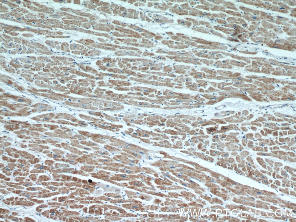 Immunohistochemistry (IHC) staining of human heart tissue using RWDD3 Polyclonal antibody (22737-1-AP)