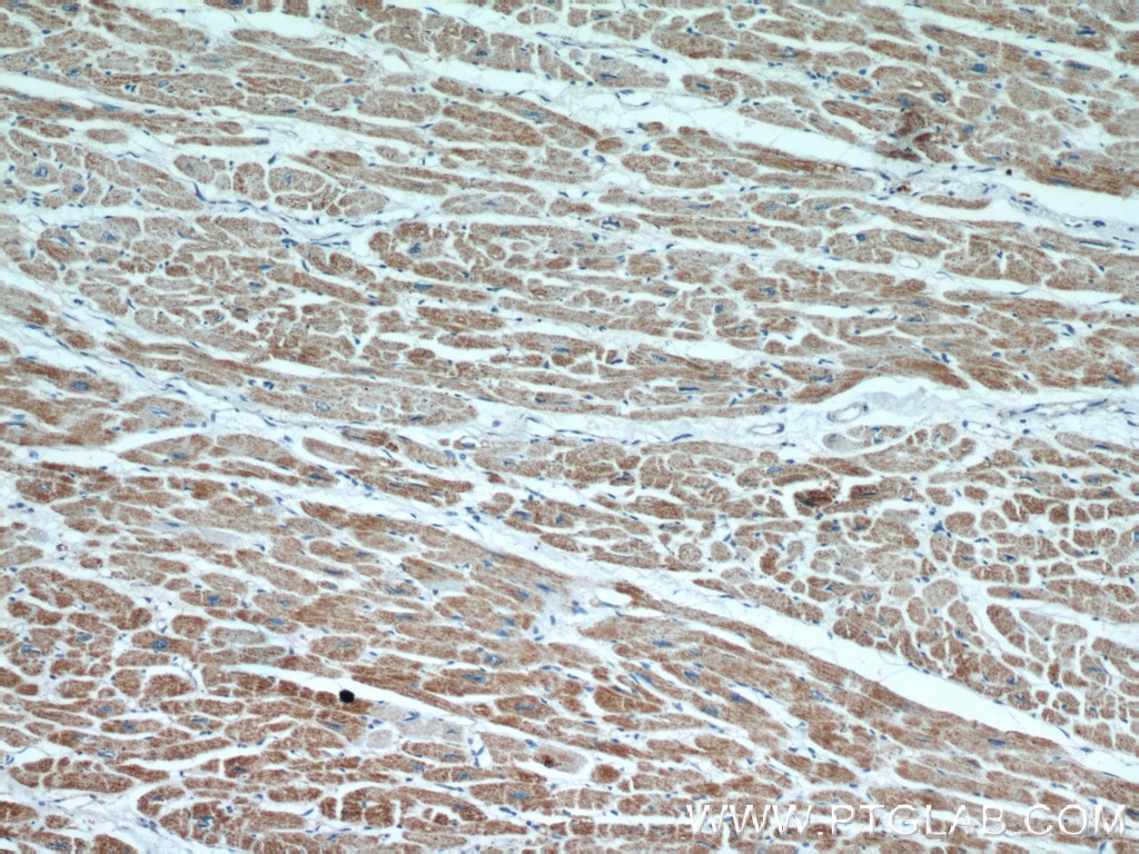 IHC staining of human heart using 22737-1-AP