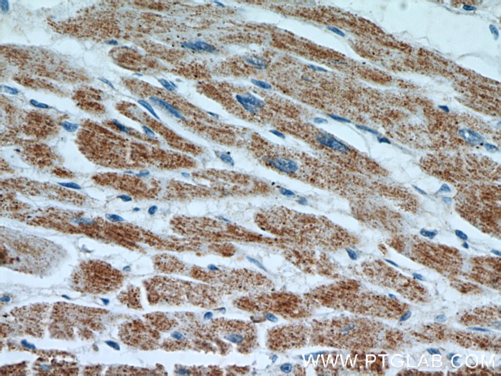 Immunohistochemistry (IHC) staining of human heart tissue using RWDD3 Polyclonal antibody (22737-1-AP)