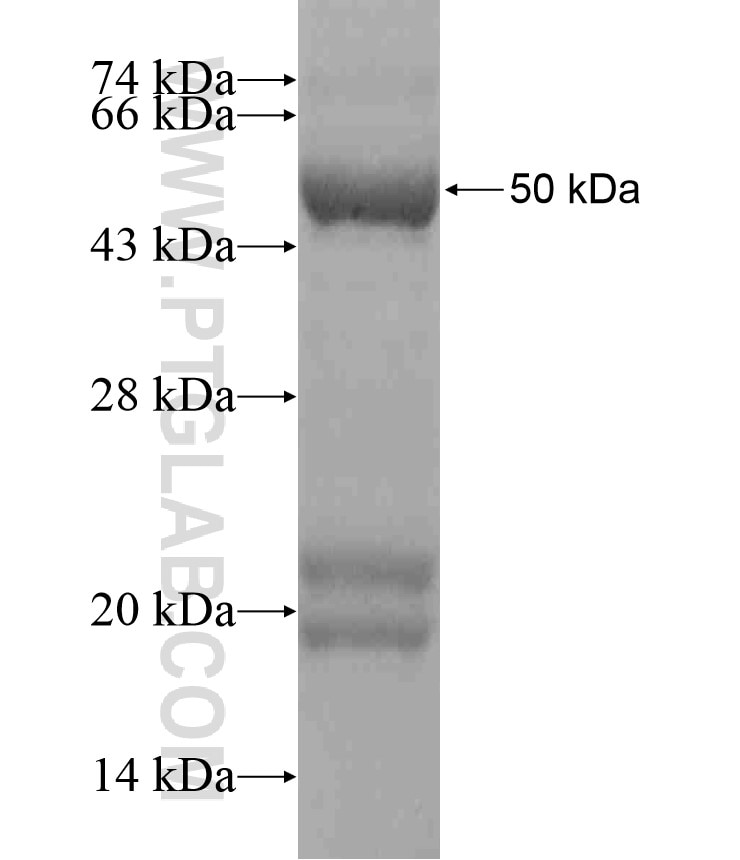 RWDD3 fusion protein Ag18576 SDS-PAGE