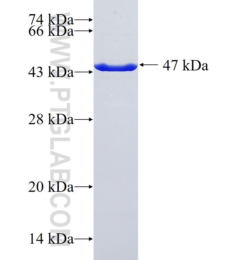 RWDD4A fusion protein Ag36777 SDS-PAGE