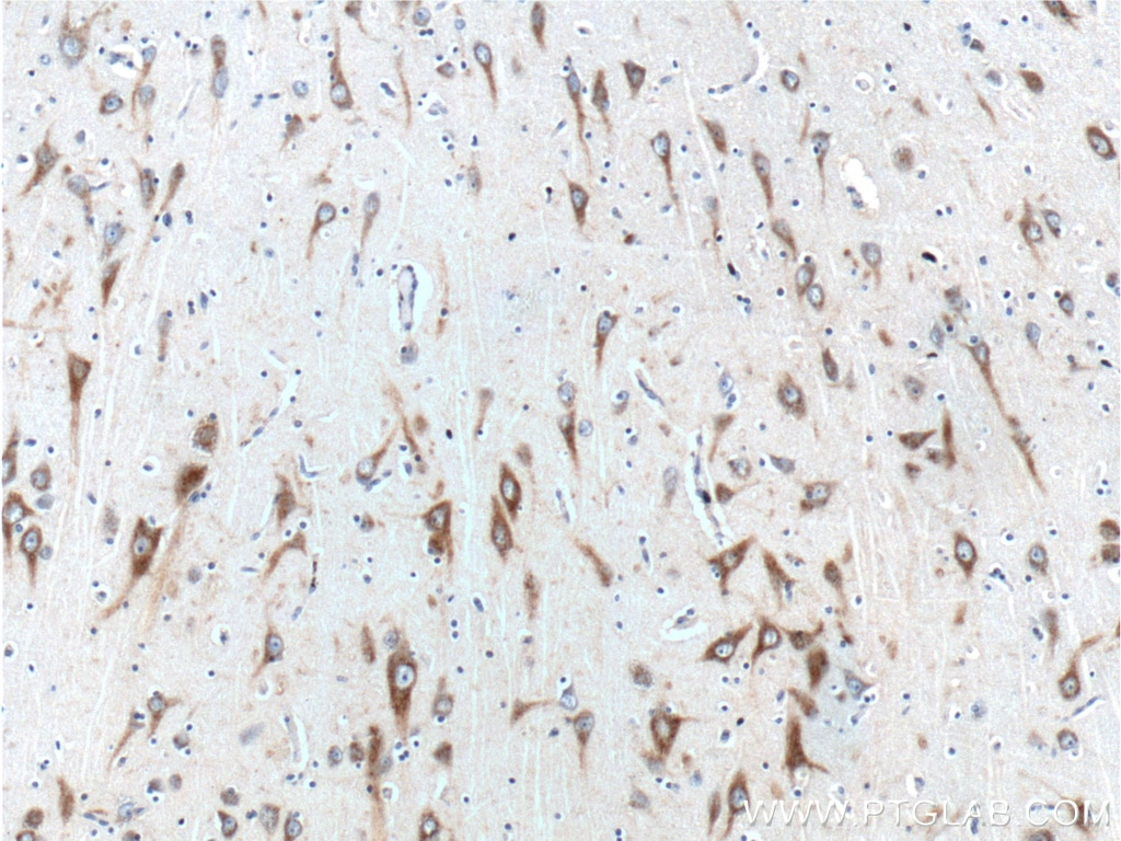 Immunohistochemistry (IHC) staining of human brain tissue using RXFP1 Polyclonal antibody (18419-1-AP)