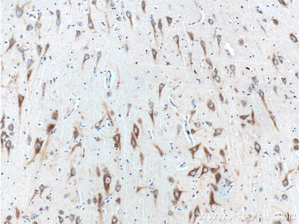 IHC staining of human brain using 18419-1-AP