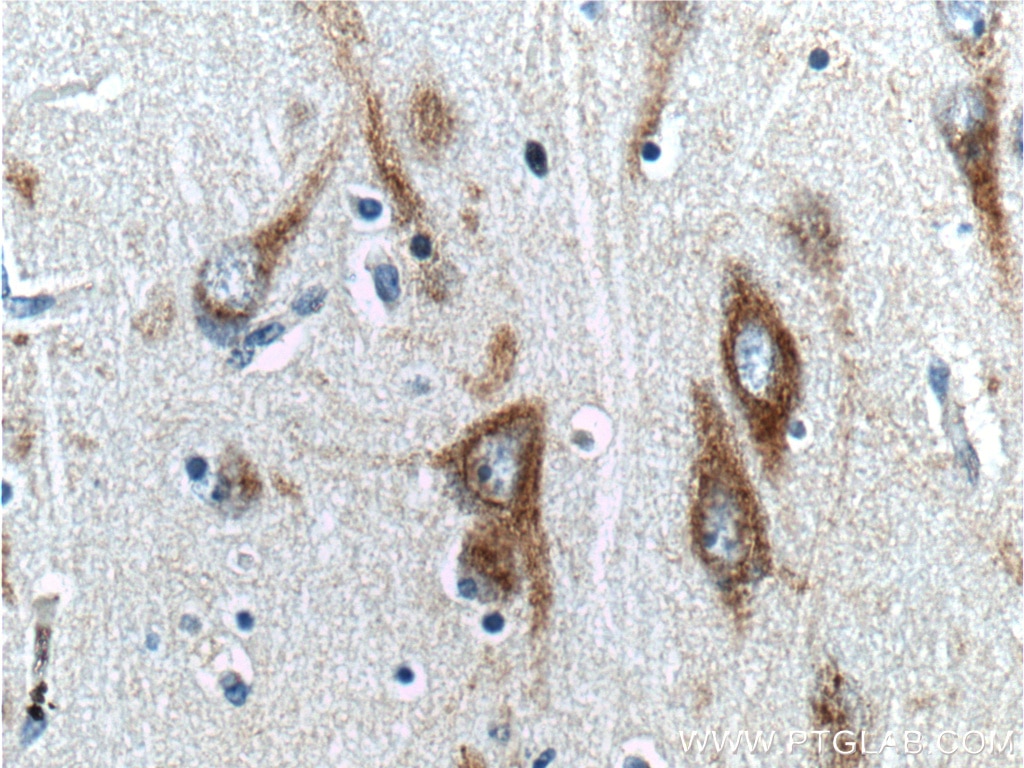 IHC staining of human brain using 18419-1-AP