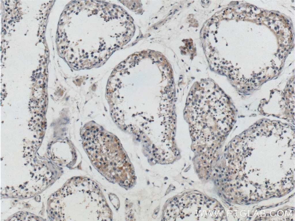 Immunohistochemistry (IHC) staining of human testis tissue using RXFP1 Polyclonal antibody (18419-1-AP)