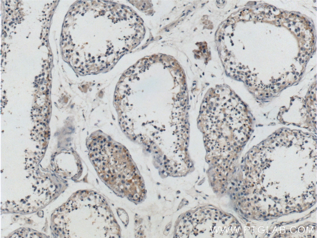 IHC staining of human testis using 18419-1-AP