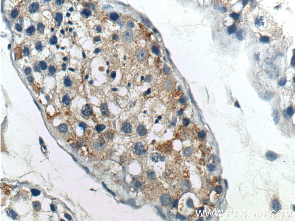 Immunohistochemistry (IHC) staining of human testis tissue using RXFP1 Polyclonal antibody (18419-1-AP)