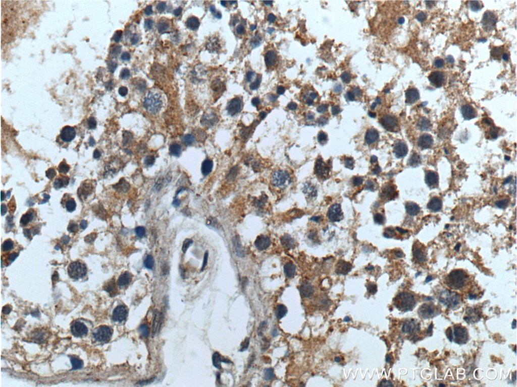 Immunohistochemistry (IHC) staining of human testis tissue using RXFP4 Polyclonal antibody (20550-1-AP)