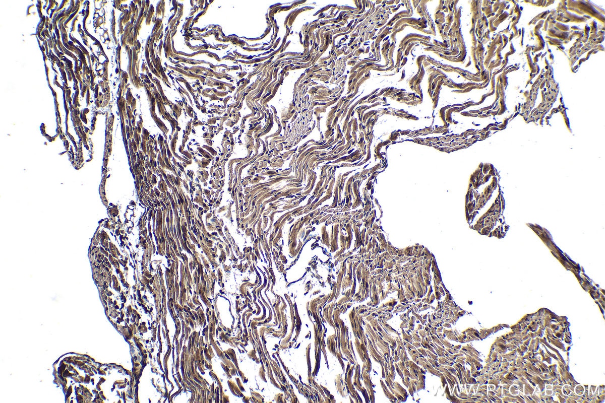 Immunohistochemistry (IHC) staining of mouse heart tissue using RXRA Polyclonal antibody (21218-1-AP)