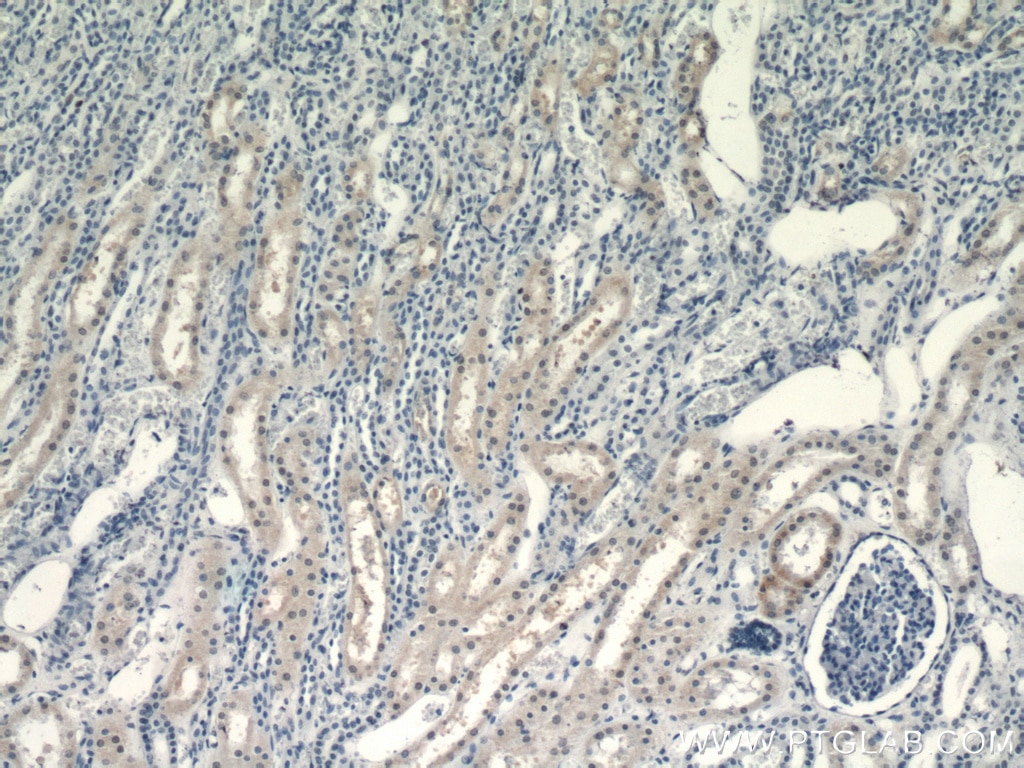 Immunohistochemistry (IHC) staining of human kidney tissue using RXRA Polyclonal antibody (21218-1-AP)