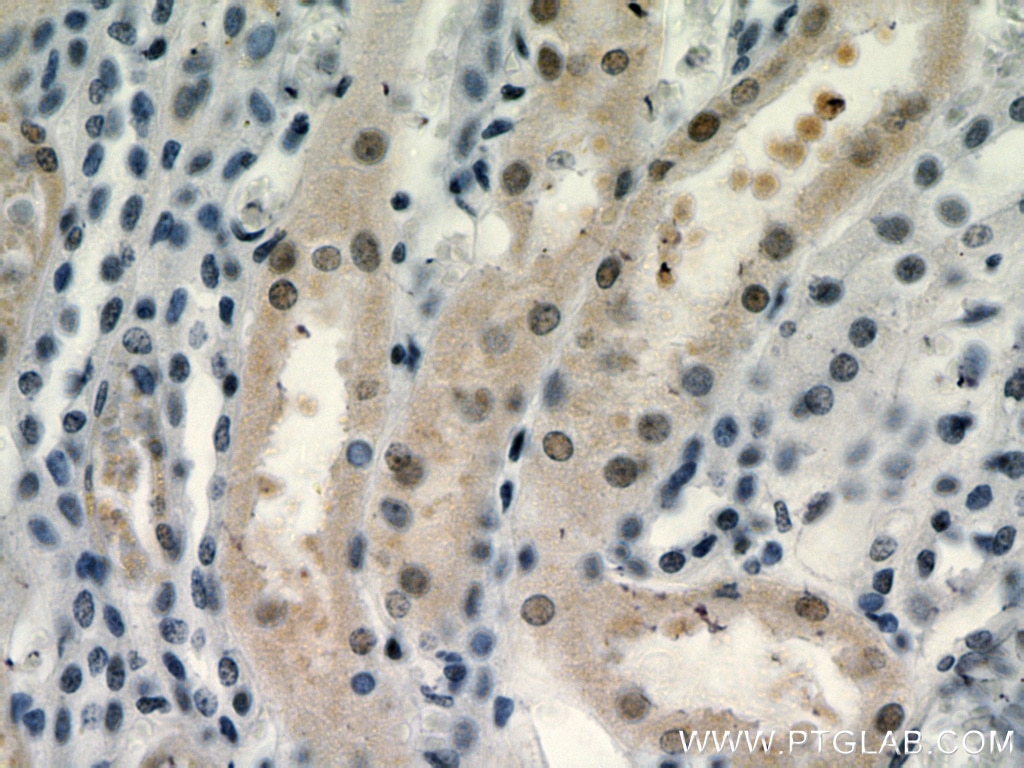 Immunohistochemistry (IHC) staining of human kidney tissue using RXRA Polyclonal antibody (21218-1-AP)