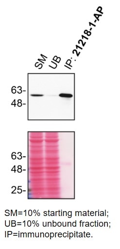 Immunoprecipitation (IP) experiment of HCT 116 cells using RXRA Polyclonal antibody (21218-1-AP)