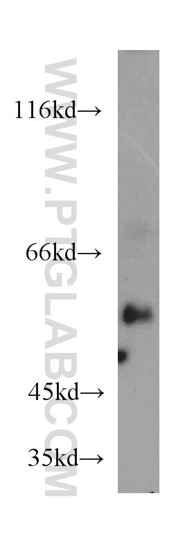Western Blot (WB) analysis of MCF-7 cells using RXRA Polyclonal antibody (21218-1-AP)