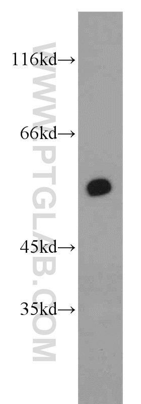 Western Blot (WB) analysis of MCF-7 cells using RXRA Polyclonal antibody (21218-1-AP)