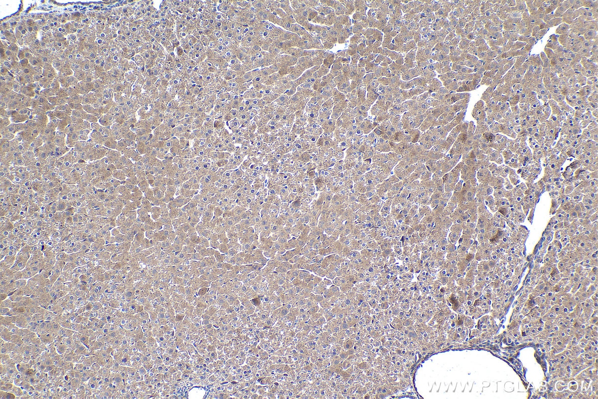 Immunohistochemistry (IHC) staining of rat liver tissue using RXRA Monoclonal antibody (60198-1-Ig)