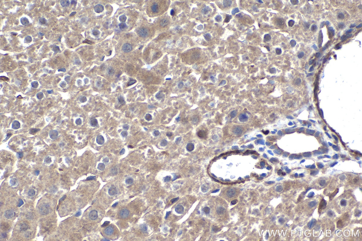 Immunohistochemistry (IHC) staining of rat liver tissue using RXRA Monoclonal antibody (60198-1-Ig)