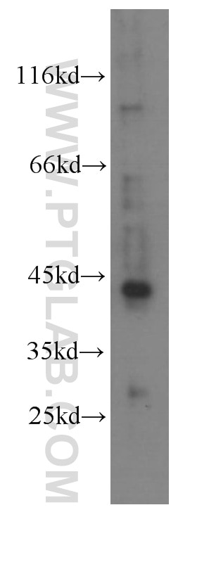 Western Blot (WB) analysis of HeLa cells using RXRA Monoclonal antibody (60198-1-Ig)