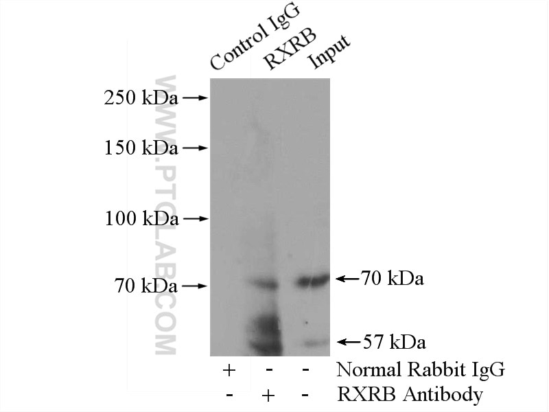 Immunoprecipitation (IP) experiment of MCF-7 cells using RXRB Polyclonal antibody (14684-1-AP)