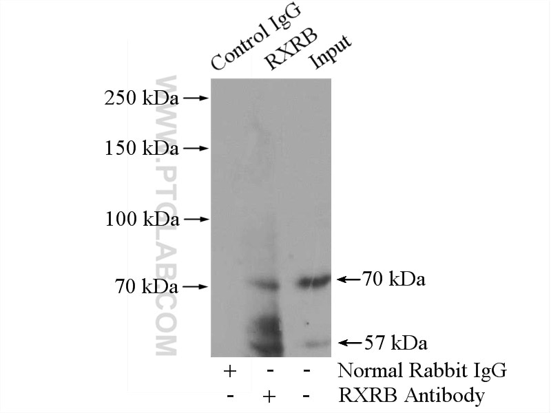 IP experiment of MCF-7 using 14684-1-AP