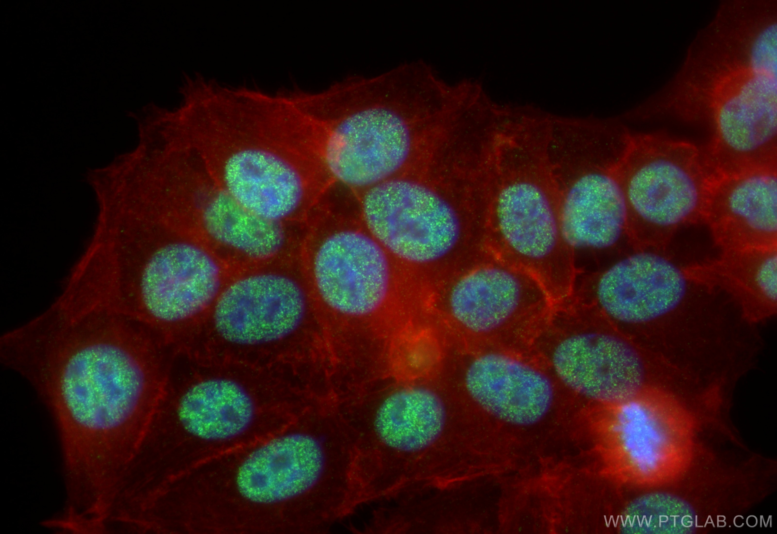 Immunofluorescence (IF) / fluorescent staining of MCF-7 cells using RXRB Recombinant antibody (84656-4-RR)