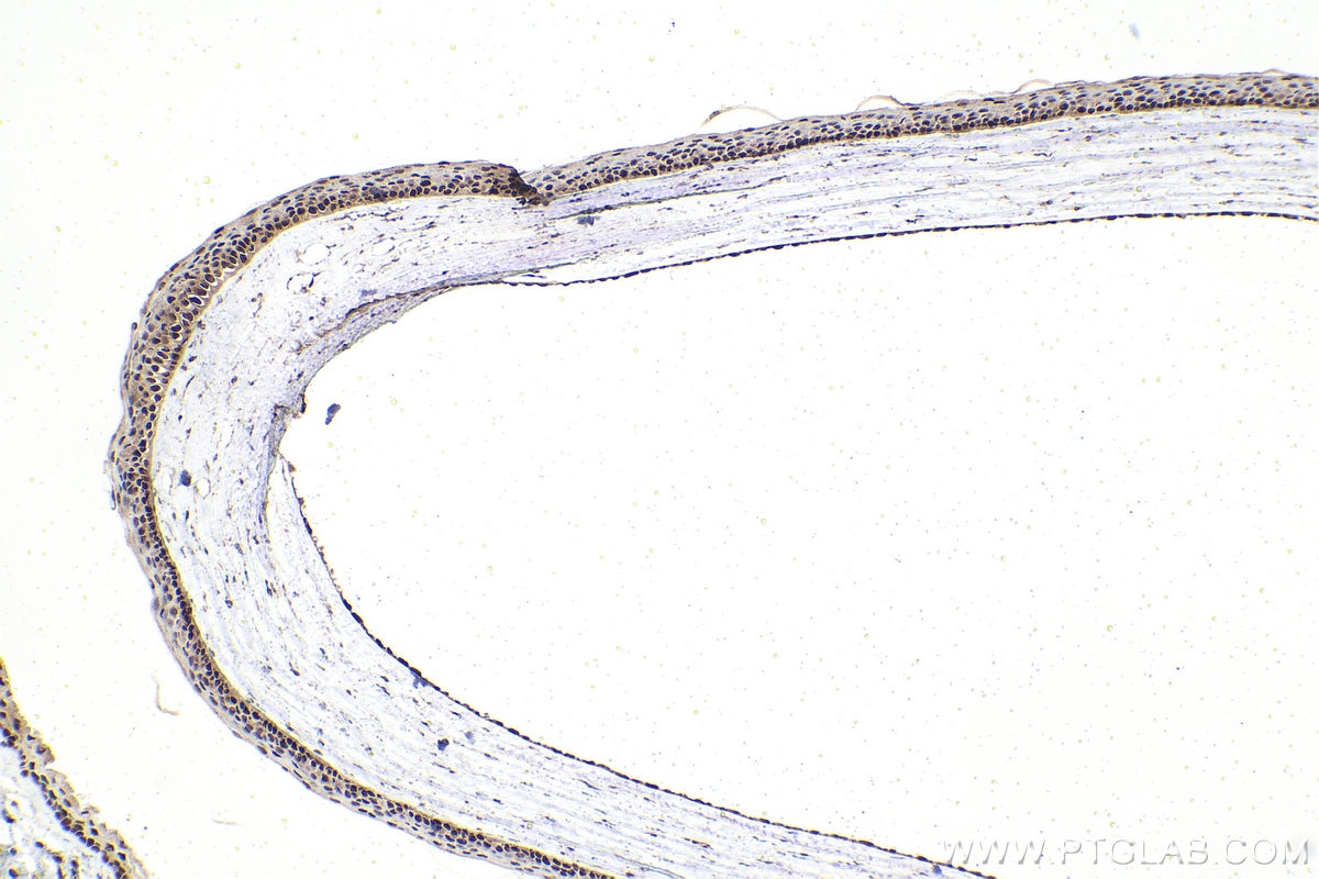 Immunohistochemistry (IHC) staining of rat eye tissue using RXRG Polyclonal antibody (11129-1-AP)