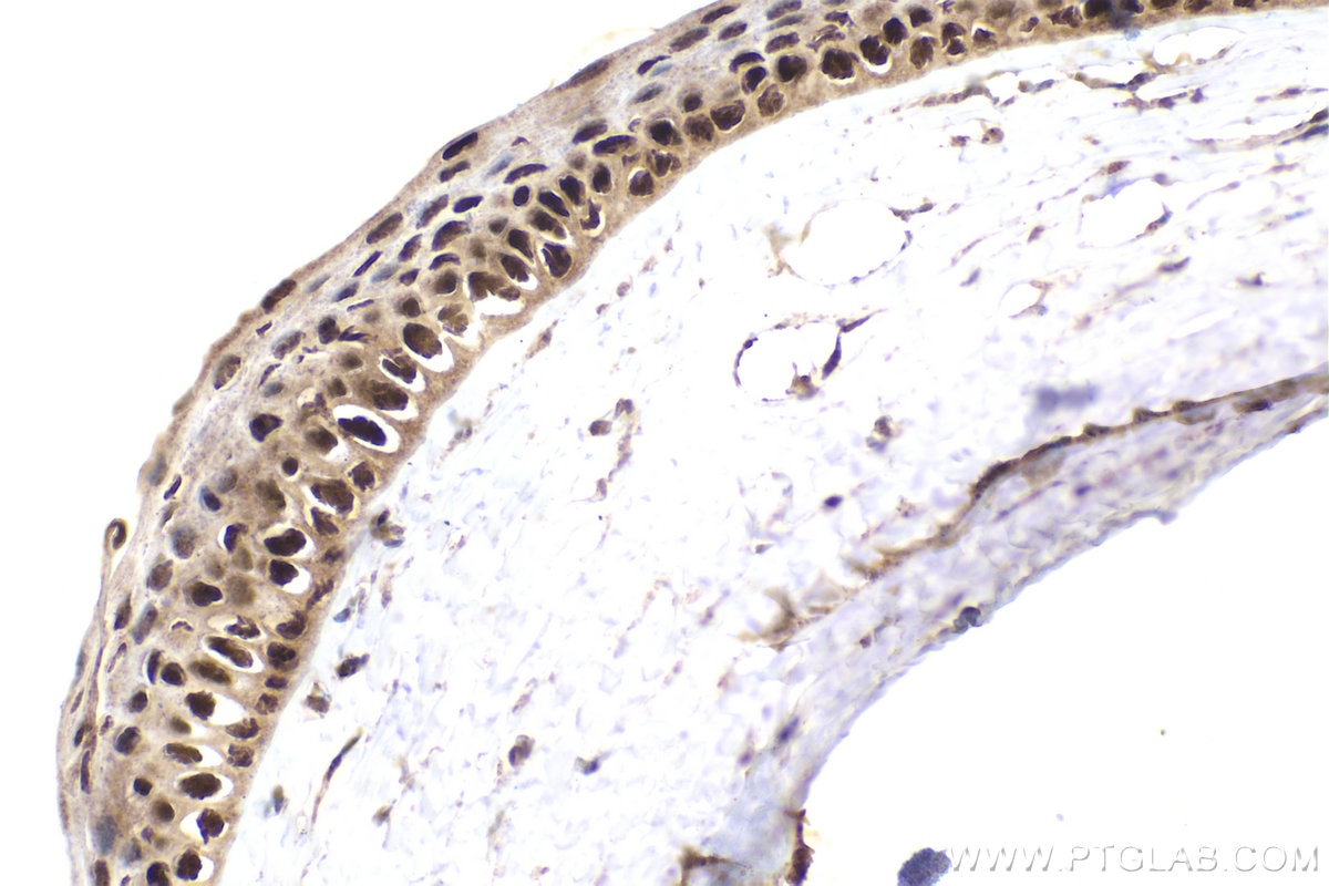 Immunohistochemistry (IHC) staining of rat eye tissue using RXRG Polyclonal antibody (11129-1-AP)