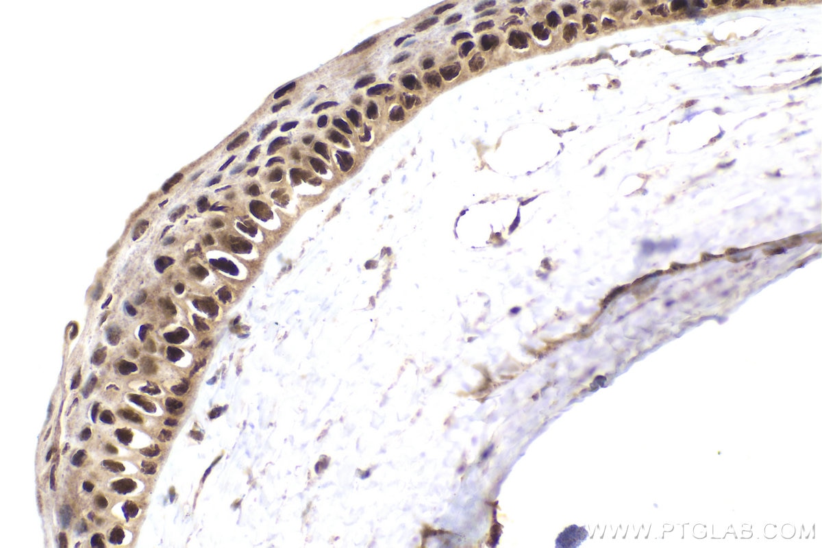 IHC staining of rat eye using 11129-1-AP