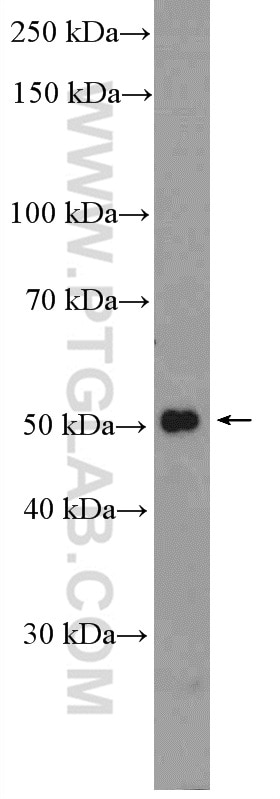 Western Blot (WB) analysis of Jurkat cells using RXRG Polyclonal antibody (11129-1-AP)