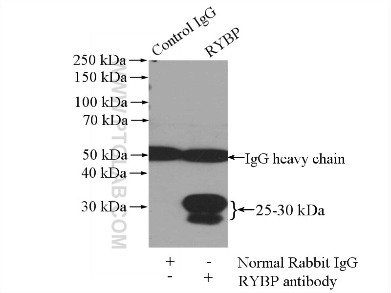 Immunoprecipitation (IP) experiment of mouse spleen tissue using RYBP Polyclonal antibody (11365-1-AP)