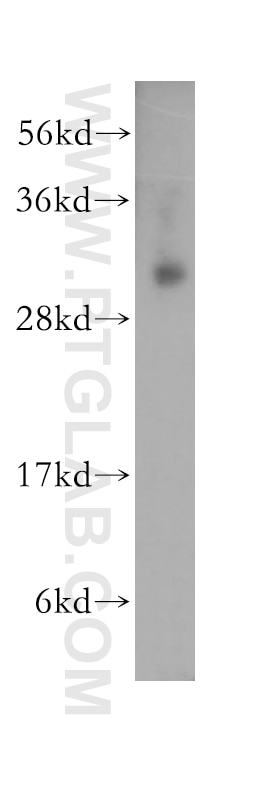 Western Blot (WB) analysis of K-562 cells using RYBP Polyclonal antibody (11365-1-AP)