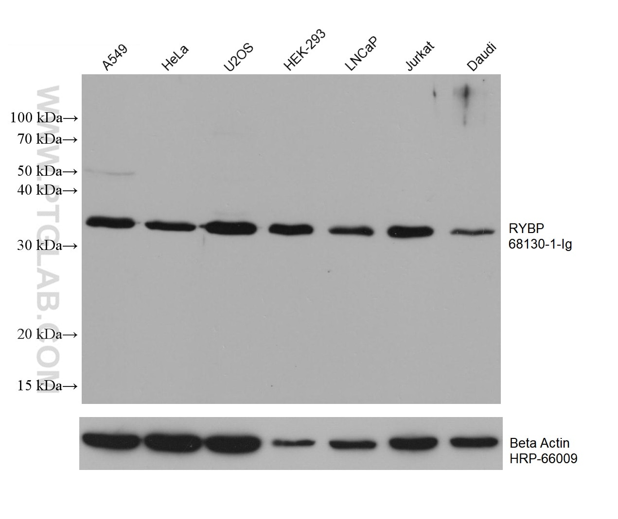 Western Blot (WB) analysis of various lysates using RYBP Monoclonal antibody (68130-1-Ig)