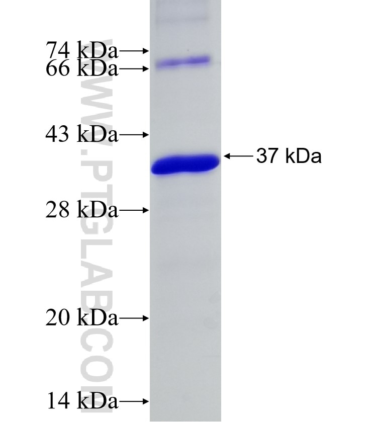 RYBP fusion protein Ag31715 SDS-PAGE