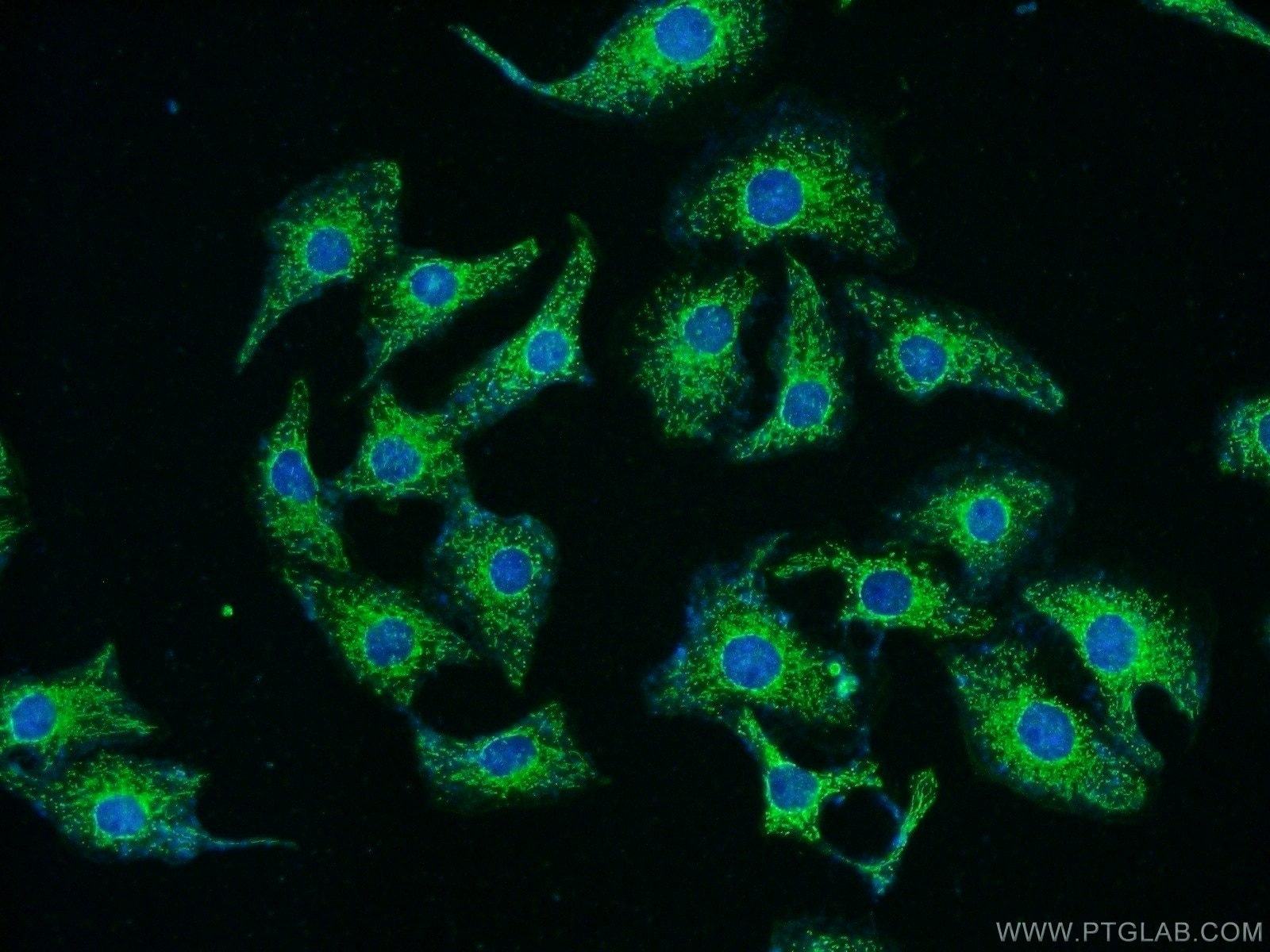 Immunofluorescence (IF) / fluorescent staining of SH-SY5Y cells using RYK Polyclonal antibody (22138-1-AP)