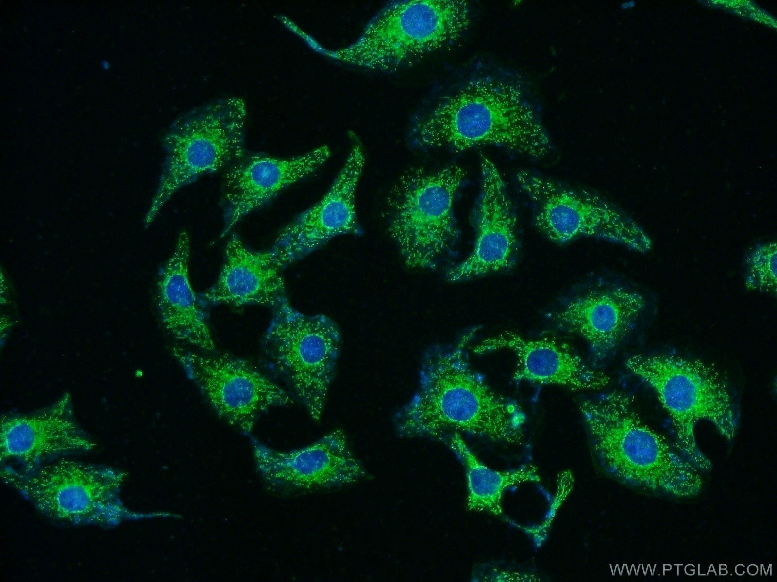 IF Staining of SH-SY5Y using 22138-1-AP