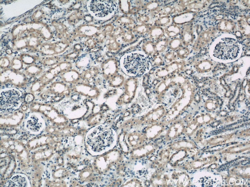 Immunohistochemistry (IHC) staining of human kidney tissue using RYK Polyclonal antibody (22138-1-AP)