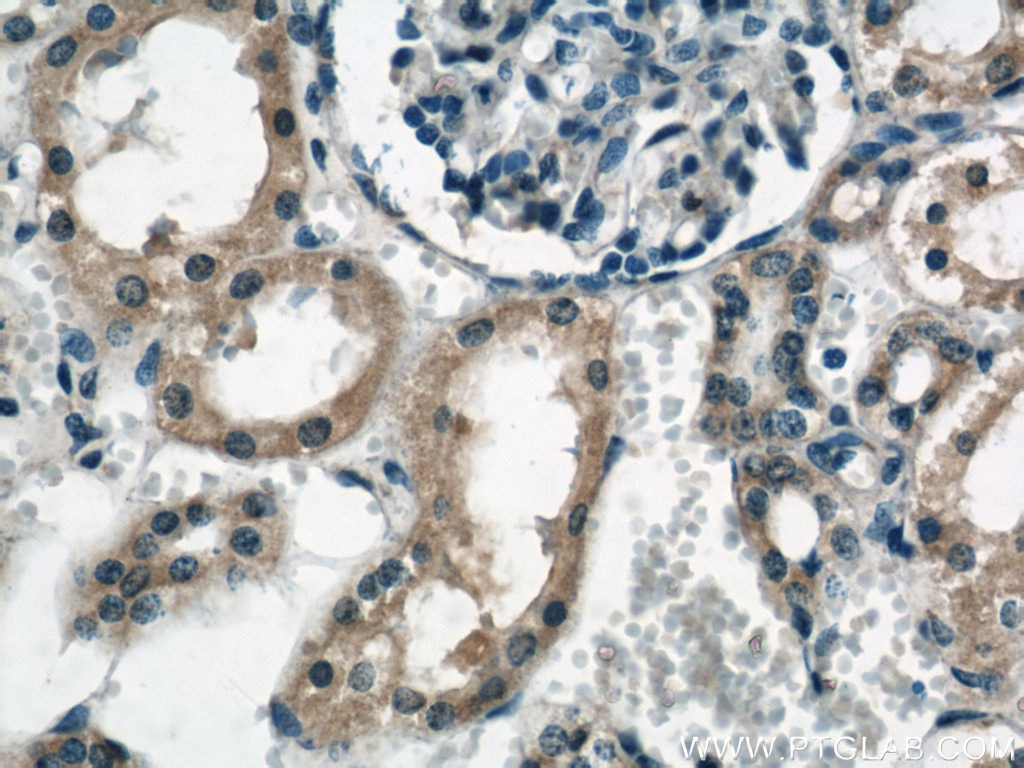 Immunohistochemistry (IHC) staining of human kidney tissue using RYK Polyclonal antibody (22138-1-AP)