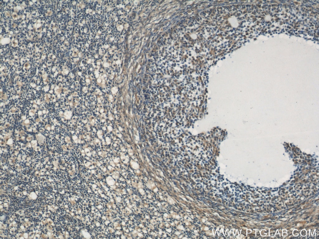 Immunohistochemistry (IHC) staining of human ovary tissue using RYK Polyclonal antibody (22138-1-AP)
