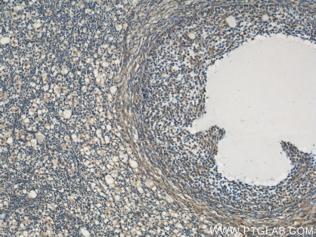 IHC staining of human ovary using 22138-1-AP